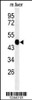 Western blot analysis of WAS Antibody in mouse liver tissue lysates (35ug/lane)