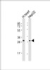 Western Blot at 1:4000 dilution Lane 1: human heart lysate Lane 2: HepG2 whole cell lysate Lysates/proteins at 20 ug per lane.