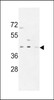 Western blot analysis in MDA-MB231, CEM, HL-60 cell line lysates (35ug/lane) .