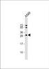 Western Blot at 1:1000 dilution + A549 whole cell lysate Lysates/proteins at 20 ug per lane.
