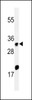 Western blot analysis of ELOVL5 Antibody in Hela cell line lysates (35ug/lane)