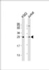 Western Blot at 1:2000 dilution Lane 1: K562 whole cell lysates Lane 2: Jurkat whole cell lysates Lysates/proteins at 20 ug per lane.