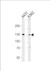 Western blot analysis of lysates from A431, K562 cell line (from left to right) , using GALNT5 Antibody at 1:1000 at each lane.