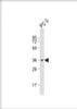 Western Blot at 1:1000 dilution + PC-3 whole cell lysate Lysates/proteins at 20 ug per lane.