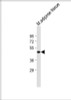 Western blot analysis in Mouse adipose tissue lysate (20ug/lane) .