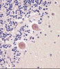 Staining TNMD in human cerebellum tissue sections by Immunohistochemistry (IHC-P - paraformaldehyde-fixed, paraffin-embedded sections) . Tissue was fixed with formaldehyde and blocked with 3% BSA for 0. 5 hour at room temperature; antigen retrieval was by heat mediation with a citrate buffer (pH6) . Samples were incubated with primary antibody (1/25) for 1 hours at 37C. A undiluted biotinylated goat polyvalent antibody was used as the secondary antibody.