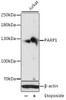 Western blot analysis of extracts of various cell lines, using PARP1 antibody (13-003) at 1:1000 dilution. Jurkat cells were treated by Etoposide (25 uM) at 37℃ for 5 hours.<br/>Secondary antibody: HRP Goat Anti-Rabbit IgG (H+L) at 1:10000 dilution.<br/>Lysates/proteins: 25ug per lane.<br/>Blocking buffer: 3% nonfat dry milk in TBST.<br/>Detection: ECL Basic Kit.<br/>Exposure time: 10s.