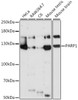 Western blot analysis of extracts of various cell lines, using PARP1 antibody (13-003) at 1:1000 dilution.<br/>Secondary antibody: HRP Goat Anti-Rabbit IgG (H+L) at 1:10000 dilution.<br/>Lysates/proteins: 25ug per lane.<br/>Blocking buffer: 3% nonfat dry milk in TBST.<br/>Detection: ECL Basic Kit.<br/>Exposure time: 10s.