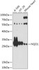 Western blot analysis of extracts of various cell lines, using NQO1 antibody (13-015) at 1:1000 dilution.<br/>Secondary antibody: HRP Goat Anti-Rabbit IgG (H+L) at 1:10000 dilution.<br/>Lysates/proteins: 25ug per lane.<br/>Blocking buffer: 3% nonfat dry milk in TBST.<br/>Detection: ECL Basic Kit.<br/>Exposure time: 90s.