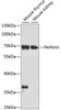 Western blot analysis of extracts of various cell lines, using Perforin antibody (13-029) at 1:1000 dilution.<br/>Secondary antibody: HRP Goat Anti-Rabbit IgG (H+L) at 1:10000 dilution.<br/>Lysates/proteins: 25ug per lane.<br/>Blocking buffer: 3% nonfat dry milk in TBST.<br/>Detection: ECL Basic Kit.<br/>Exposure time: 30s.