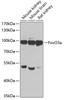 Western blot analysis of extracts of various cell lines, using FoxO3a antibody (13-033) at 1:1000 dilution.<br/>Secondary antibody: HRP Goat Anti-Rabbit IgG (H+L) at 1:10000 dilution.<br/>Lysates/proteins: 25ug per lane.<br/>Blocking buffer: 3% nonfat dry milk in TBST.<br/>Detection: ECL Basic Kit.<br/>Exposure time: 60s.