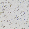 Immunohistochemistry of paraffin-embedded rat brain using FoxO3a antibody (13-033) at dilution of 1:100 (40x lens) .