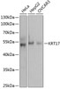 Western blot analysis of extracts of various cell lines, using KRT17 antibody (13-043) at 1:1000 dilution.<br/>Secondary antibody: HRP Goat Anti-Rabbit IgG (H+L) at 1:10000 dilution.<br/>Lysates/proteins: 25ug per lane.<br/>Blocking buffer: 3% nonfat dry milk in TBST.