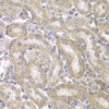 Immunohistochemistry of paraffin-embedded rat kidney using KRT17 antibody (13-043) at dilution of 1:200 (40x lens) .