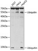 Western blot analysis of extracts of various cell lines, using Ubiquitin antibody (13-062) .<br/>Secondary antibody: HRP Goat Anti-Rabbit IgG (H+L) at 1:10000 dilution.<br/>Lysates/proteins: 25ug per lane.<br/>Blocking buffer: 3% nonfat dry milk in TBST.