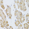 Immunohistochemistry of paraffin-embedded human stomach using HDAC4 antibody (13-068) at dilution of 1:100 (40x lens) .