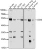 Western blot analysis of extracts of various cell lines, using CD40 Antibody (13-083) at 1:1000 dilution.<br/>Secondary antibody: HRP Goat Anti-Rabbit IgG (H+L) at 1:10000 dilution.<br/>Lysates/proteins: 25ug per lane.<br/>Blocking buffer: 3% nonfat dry milk in TBST.<br/>Detection: ECL Basic Kit.<br/>Exposure time: 5s.