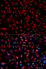 Immunofluorescence analysis of HeLa cells using DOK4 antibody (13-088) . Blue: DAPI for nuclear staining.