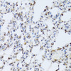 Immunohistochemistry of paraffin-embedded rat lung using MAPK3 Antibody (13-089) at dilution of 1:100 (40x lens) .