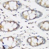 Immunohistochemistry of paraffin-embedded human colon using BMP2 antibody (13-091) at dilution of 1:200 (40x lens) .