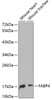 Western blot analysis of extracts of various cell lines, using FABP4 antibody (13-092) .<br/>Secondary antibody: HRP Goat Anti-Rabbit IgG (H+L) at 1:10000 dilution.<br/>Lysates/proteins: 25ug per lane.<br/>Blocking buffer: 3% nonfat dry milk in TBST.