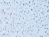 Immunohistochemistry of paraffin-embedded rat heart using FABP4 antibody (13-092) at dilution of 1:100 (40x lens) .