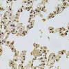 Immunohistochemistry of paraffin-embedded rat lung using FGF2 antibody (13-095) at dilution of 1:100 (40x lens) .