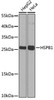 Western blot analysis of extracts of various cell lines, using HSPB1 antibody (13-100) at 1:1000 dilution.<br/>Secondary antibody: HRP Goat Anti-Rabbit IgG (H+L) at 1:10000 dilution.<br/>Lysates/proteins: 25ug per lane.<br/>Blocking buffer: 3% nonfat dry milk in TBST.<br/>Detection: ECL Basic Kit.<br/>Exposure time: 90s.