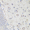 Immunohistochemistry of paraffin-embedded rat brain using GRP78 / BiP antibody (13-101) at dilution of 1:100 (40x lens) .