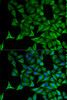 Immunofluorescence analysis of HeLa cells using KRT20 antibody (13-105) . Blue: DAPI for nuclear staining.