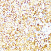 Immunohistochemistry of paraffin-embedded rat ovary using PBEF / NAMPT antibody (13-109) at dilution of 1:100 (40x lens) .