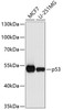 Western blot analysis of extracts of various cell lines, using p53 antibody (13-113) at 1:1000 dilution.<br/>Secondary antibody: HRP Goat Anti-Rabbit IgG (H+L) at 1:10000 dilution.<br/>Lysates/proteins: 25ug per lane.<br/>Blocking buffer: 3% nonfat dry milk in TBST.<br/>Detection: ECL Basic Kit.<br/>Exposure time: 90s.