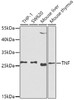 Western blot analysis of extracts of various cell lines, using TNF-α antibody (13-123) at 1:1000 dilution.<br/>Secondary antibody: HRP Goat Anti-Rabbit IgG (H+L) at 1:10000 dilution.<br/>Lysates/proteins: 25ug per lane.<br/>Blocking buffer: 3% nonfat dry milk in TBST.<br/>Detection: ECL Basic Kit.<br/>Exposure time: 90s.