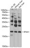 Western blot analysis of extracts of various cell lines, using IFNA1 antibody (13-128) at 1:1000 dilution.<br/>Secondary antibody: HRP Goat Anti-Rabbit IgG (H+L) at 1:10000 dilution.<br/>Lysates/proteins: 25ug per lane.<br/>Blocking buffer: 3% nonfat dry milk in TBST.<br/>Detection: ECL Basic Kit.<br/>Exposure time: 5s.