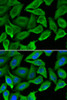 Immunofluorescence analysis of A549 cells using IFNA1 antibody (13-128) . Blue: DAPI for nuclear staining.