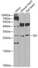 Western blot analysis of extracts of various cell lines, using IL6 antibody (13-129) at 1:1000 dilution.<br/>Secondary antibody: HRP Goat Anti-Rabbit IgG (H+L) at 1:10000 dilution.<br/>Lysates/proteins: 25ug per lane.<br/>Blocking buffer: 3% nonfat dry milk in TBST.<br/>Detection: ECL Basic Kit.<br/>Exposure time: 90s.