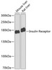 Western blot analysis of extracts of various cell lines, using Insulin Receptor antibody (13-130) at 1:1000 dilution.<br/>Secondary antibody: HRP Goat Anti-Rabbit IgG (H+L) at 1:10000 dilution.<br/>Lysates/proteins: 25ug per lane.<br/>Blocking buffer: 3% nonfat dry milk in TBST.<br/>Detection: ECL Enhanced Kit.<br/>Exposure time: 90s.
