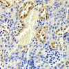 Immunohistochemistry of paraffin-embedded mouse kidney using CDKN1B Antibody (13-132) at dilution of 1:200 (40x lens) .