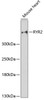 Western blot analysis of extracts of mouse heart, using RYR2 antibody (13-136) at 1:3000 dilution.<br/>Secondary antibody: HRP Goat Anti-Rabbit IgG (H+L) at 1:10000 dilution.<br/>Lysates/proteins: 25ug per lane.<br/>Blocking buffer: 3% nonfat dry milk in TBST.<br/>Detection: ECL Enhanced Kit.<br/>Exposure time: 90s.