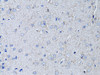 Immunohistochemistry of paraffin-embedded rat brain using RYR2 Antibody (13-136) at dilution of 1:100 (40x lens) .