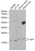 Western blot analysis of extracts of various cell lines, using IGF1 antibody (13-137) at 1:1000 dilution.<br/>Secondary antibody: HRP Goat Anti-Rabbit IgG (H+L) at 1:10000 dilution.<br/>Lysates/proteins: 25ug per lane.<br/>Blocking buffer: 3% nonfat dry milk in TBST.