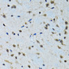Immunohistochemistry of paraffin-embedded rat brain using IGF1 antibody (13-137) at dilution of 1:100 (40x lens) .