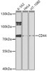 Western blot analysis of extracts of various cell lines, using CD44 antibody (13-147) at 1:1000 dilution.<br/>Secondary antibody: HRP Goat Anti-Rabbit IgG (H+L) at 1:10000 dilution.<br/>Lysates/proteins: 25ug per lane.<br/>Blocking buffer: 3% nonfat dry milk in TBST.<br/>Detection: ECL Basic Kit.<br/>Exposure time: 90s.