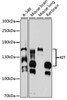 Western blot analysis of extracts of various cell lines, using KIT antibody (13-151) at 1:1000 dilution.<br/>Secondary antibody: HRP Goat Anti-Rabbit IgG (H+L) at 1:10000 dilution.<br/>Lysates/proteins: 25ug per lane.<br/>Blocking buffer: 3% nonfat dry milk in TBST.<br/>Detection: ECL Basic Kit.<br/>Exposure time: 90s.
