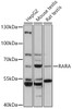 Western blot analysis of extracts of various cell lines, using RARA antibody (13-155) at 1:1000 dilution.<br/>Secondary antibody: HRP Goat Anti-Rabbit IgG (H+L) at 1:10000 dilution.<br/>Lysates/proteins: 25ug per lane.<br/>Blocking buffer: 3% nonfat dry milk in TBST.<br/>Detection: ECL Basic Kit.<br/>Exposure time: 10s.