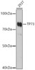 Western blot analysis of extracts of 293T cells, using TP73 antibody (13-160) at 1:1000 dilution.<br/>Secondary antibody: HRP Goat Anti-Rabbit IgG (H+L) at 1:10000 dilution.<br/>Lysates/proteins: 25ug per lane.<br/>Blocking buffer: 3% nonfat dry milk in TBST.<br/>Detection: ECL Basic Kit.<br/>Exposure time: 180s.