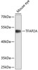 Western blot analysis of extracts of mouse eye, using TFAP2A antibody (13-168) at 1:1000 dilution._Secondary antibody: HRP Goat Anti-Rabbit IgG (H+L) at 1:10000 dilution._Lysates/proteins: 25ug per lane._Blocking buffer: 3% nonfat dry milk in TBST._Detection: ECL Enhanced Kit._Exposure time: 15s.