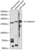 Western blot analysis of extracts of various cell lines, using N Cadherin antibody (13-171) at 1:800 dilution.<br/>Secondary antibody: HRP Goat Anti-Rabbit IgG (H+L) at 1:10000 dilution.<br/>Lysates/proteins: 25ug per lane.<br/>Blocking buffer: 3% nonfat dry milk in TBST.<br/>Detection: ECL Enhanced Kit.<br/>Exposure time: 60s.