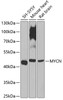 Western blot analysis of extracts of various cell lines, using MYCN antibody (13-185) at 1:1000 dilution.<br/>Secondary antibody: HRP Goat Anti-Rabbit IgG (H+L) at 1:10000 dilution.<br/>Lysates/proteins: 25ug per lane.<br/>Blocking buffer: 3% nonfat dry milk in TBST.<br/>Detection: ECL Enhanced Kit.<br/>Exposure time: 90s.