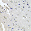 Immunohistochemistry of paraffin-embedded mouse brain using PKN1 antibody (13-202) at dilution of 1:100 (40x lens) .